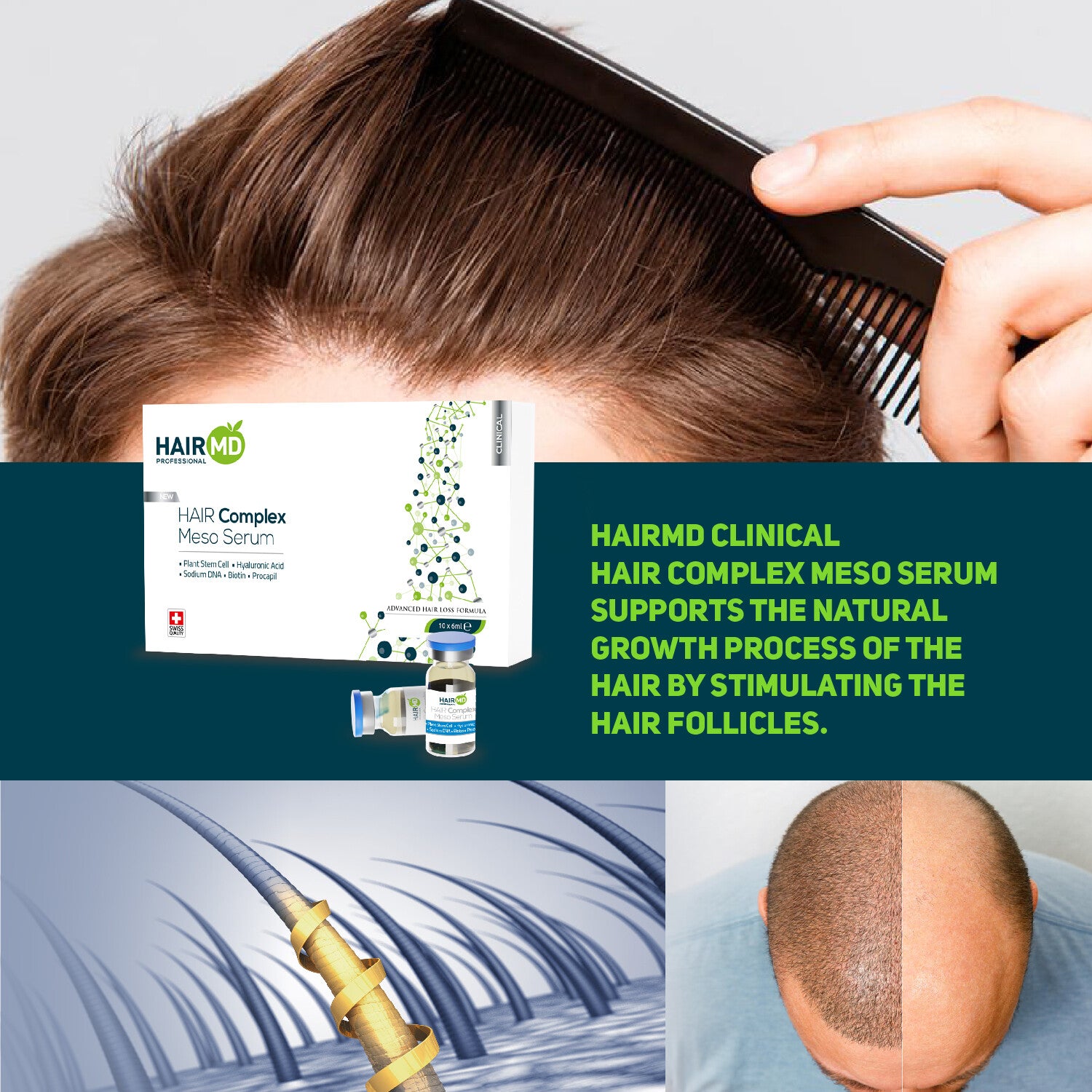 HairMD Clinical Hair Complex Meso Serum