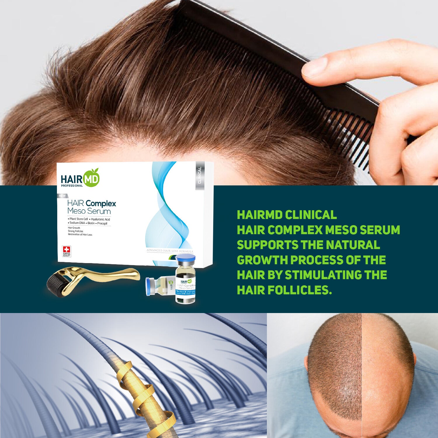 HairMD Clinical Hair Complex Meso Serum + Dermaroller Set