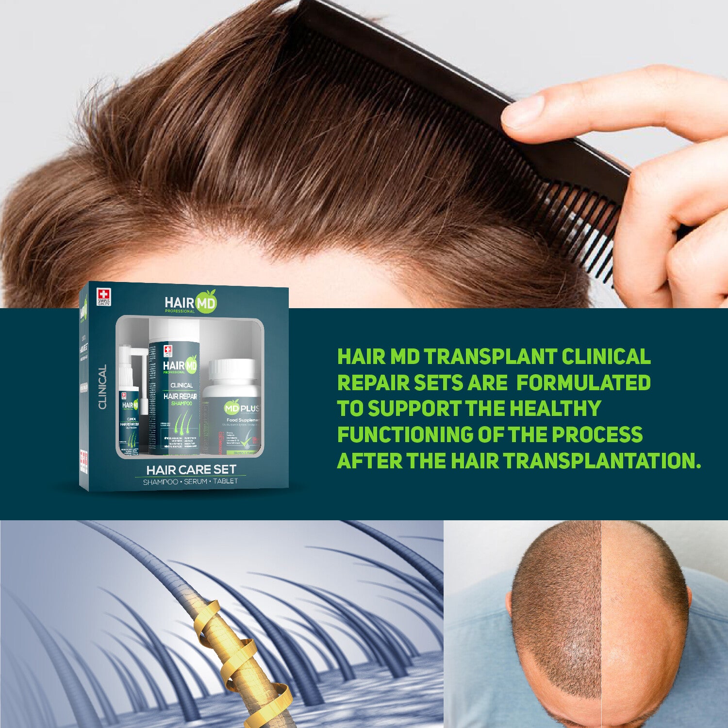 HairMD Clinical Hair Repair Set (1 month use) (Shampoo 250 ml + Serum 60 ml + Hair Multivitamin)