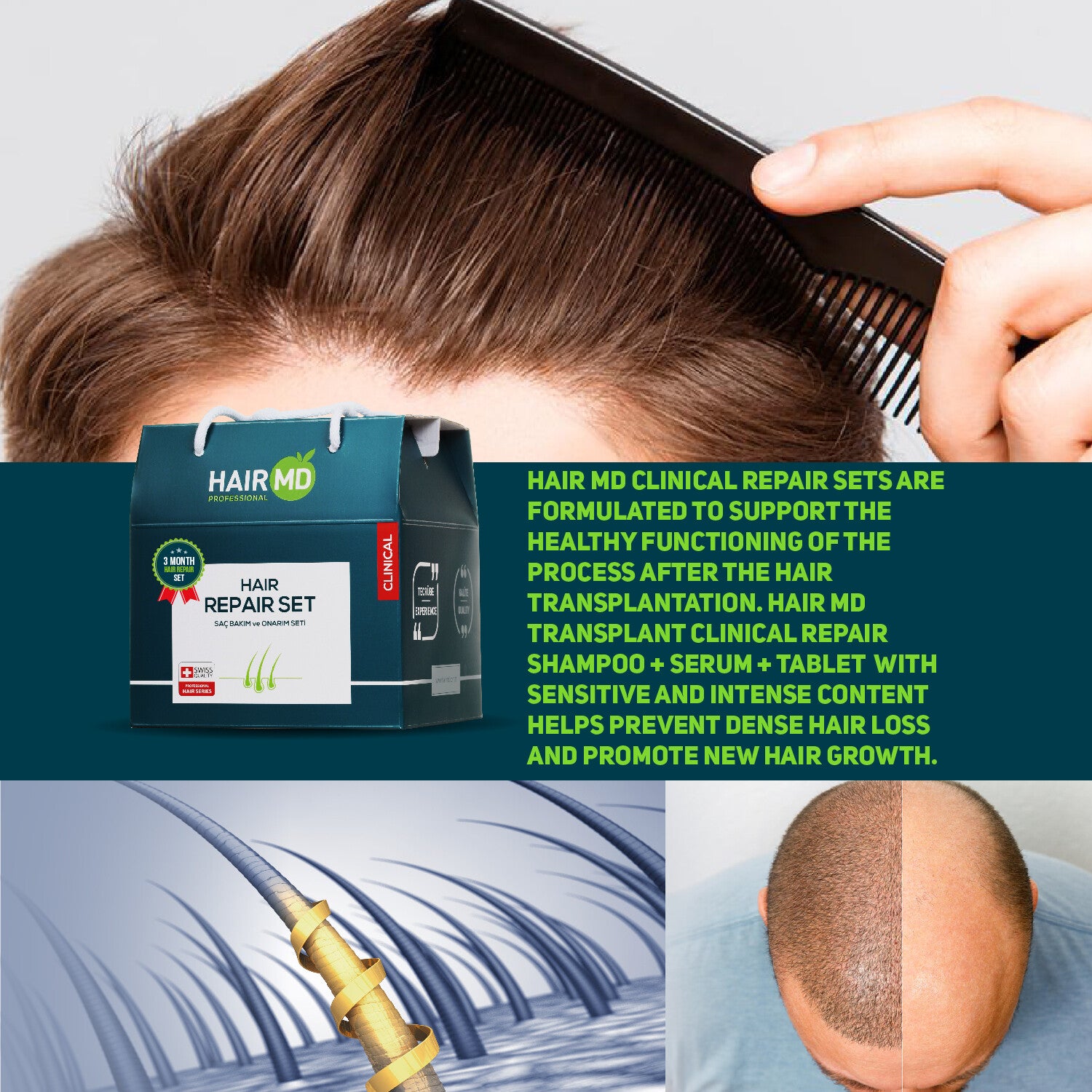 HairMD Clinical Hair Repair Set (3 month Use) ( 3 Shampoo 250 ml + 3 Serum 60 ml + 3 Hair Multivitamin)