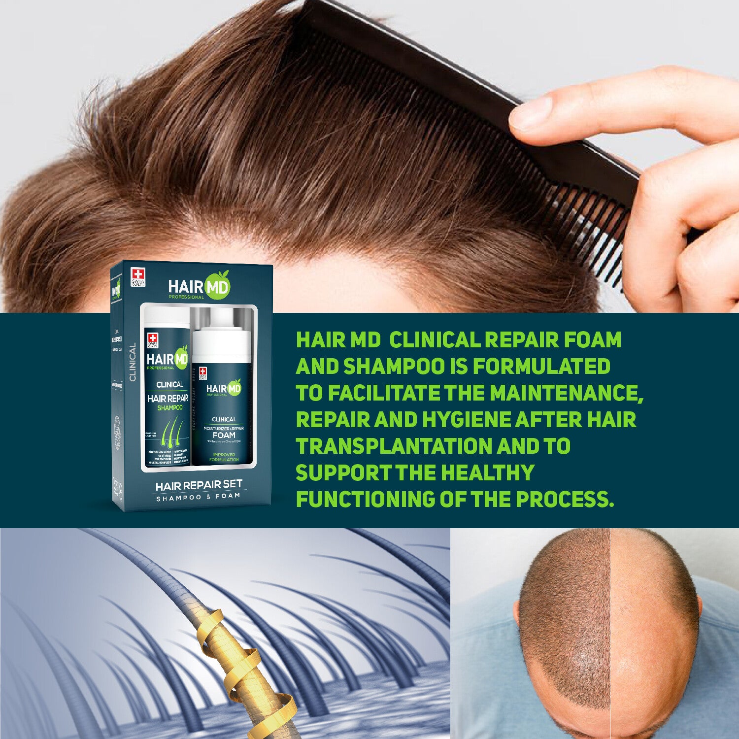 HairMD Clinical Repair Set (Shampoo 250 ml + Foam 150 ml)